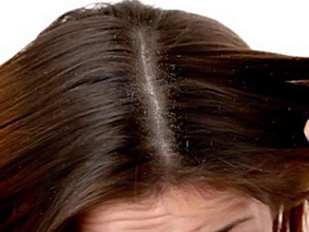 kosa-beauty-vlasište-modnialmanah