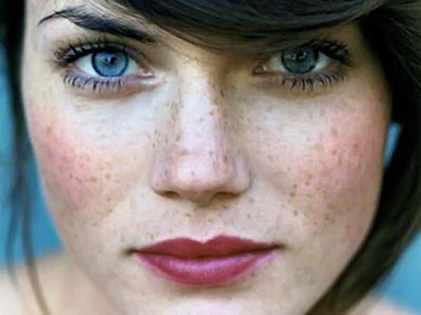 pjegice-beauty-modnialmanah