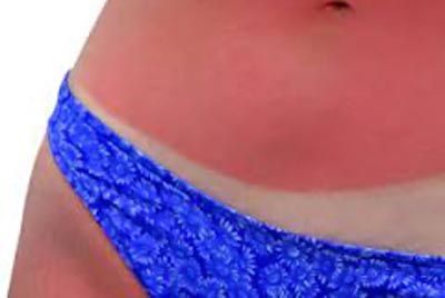 beauty-sunce-modnialmanah-koža-afrodita