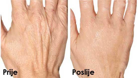 ziaja-beauty-ruke-ljepota-modnialmanah