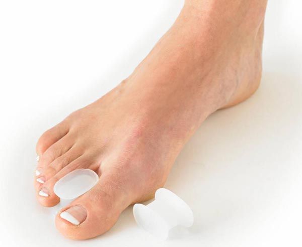 beauty-hallux-valgus-degros-stopalo-modnialmanah