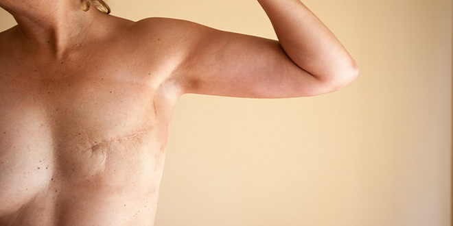 lifestyle-intimina-rak-dojke-modnialmanah