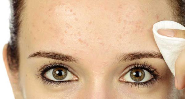 beauty-prištići-modnialmanah-lice-koža-njega