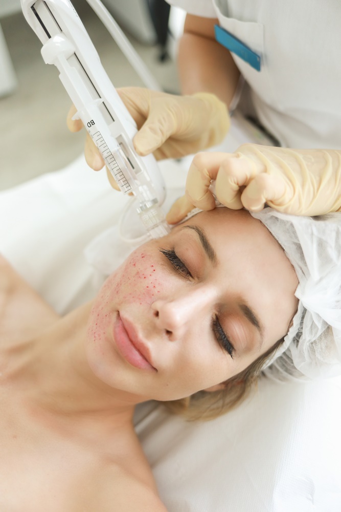 white-skin-dr-kaliterna-beauty-njega-koža-hydrafacial-tretman-egzosomi-modnialmanah