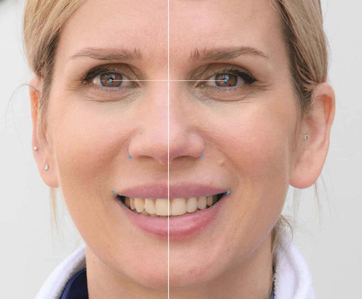 lifestyle-fotografiranje-modnialmanah-osmijeh-smijanje