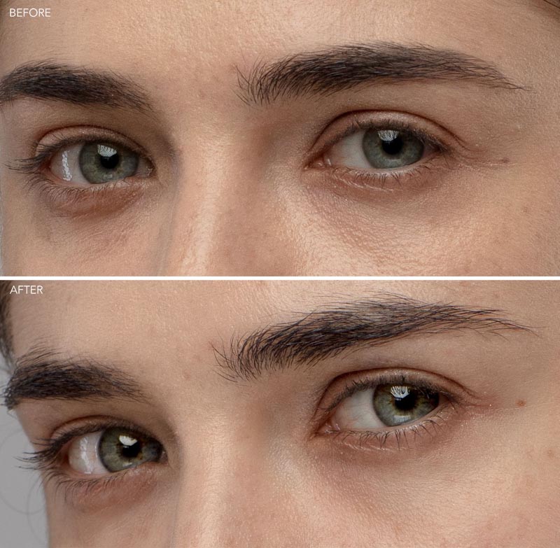 IRIS-2-beauty-foreo-masažer-modnialmanah