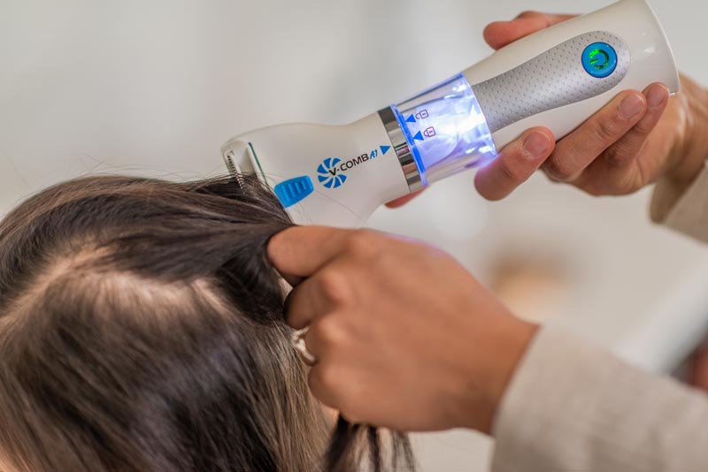 v-comb-bežični-češalj-protiv-uši-modnialmanah-kosa-hair