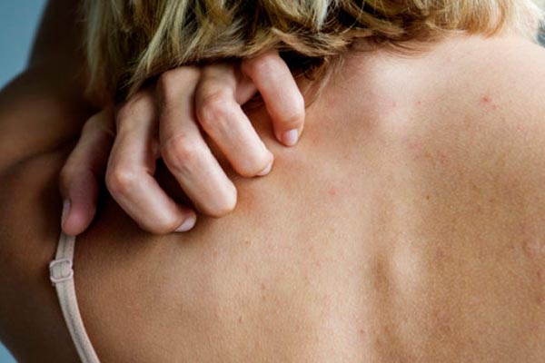 beauty-suha-koža-modnialmanah-njega-skin-skincare