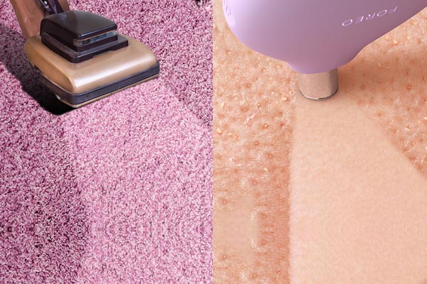 foreo-kiwi-beauty-modnialmanah-njega