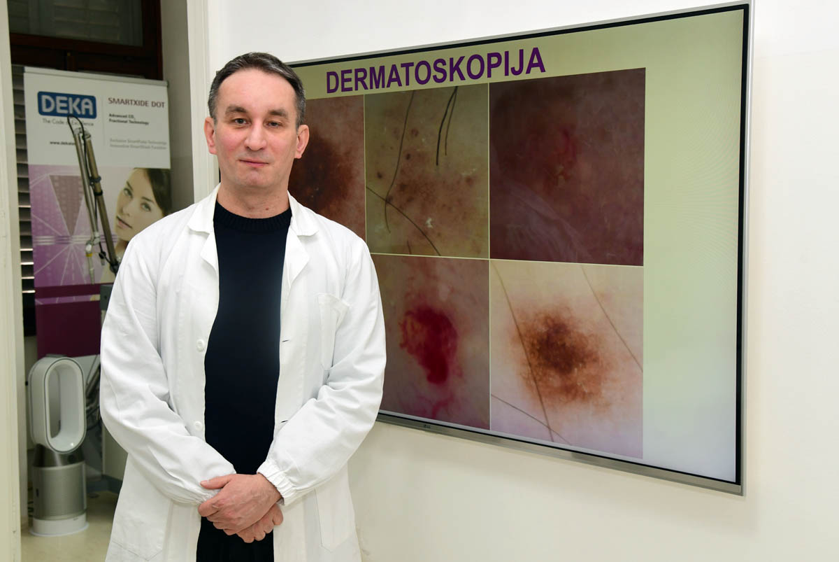 poliklinika-manestar-blažić-rijeka-dermatoskopija-zdravlje-modnialmanah