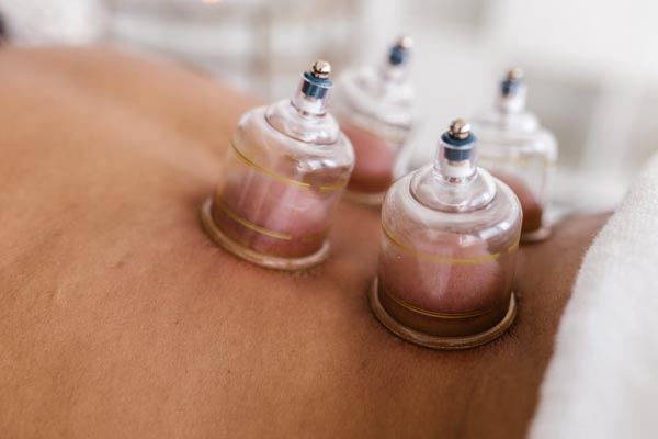 zdrav-život-cupping-modnialmanah