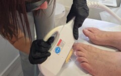 studio-kaja-gljivice-na-noktima-zdravlje-modnialmanah