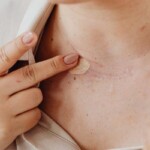 beauty-ožiljci-kako-sakriti-ožiljke-šminkom-modnialmanah