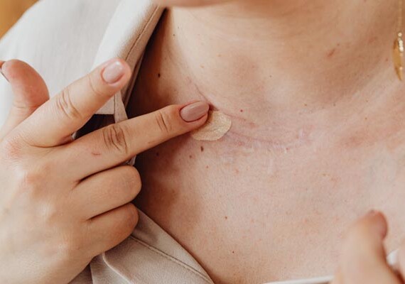 beauty-ožiljci-kako-sakriti-ožiljke-šminkom-modnialmanah