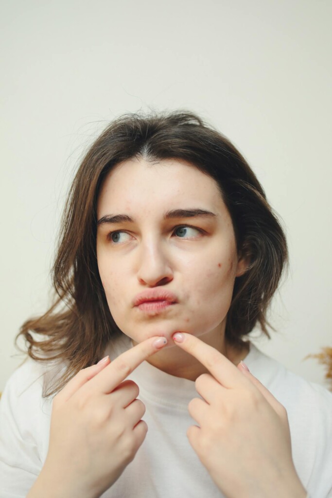 beauty-prištići-modnialmanah-koža-lice